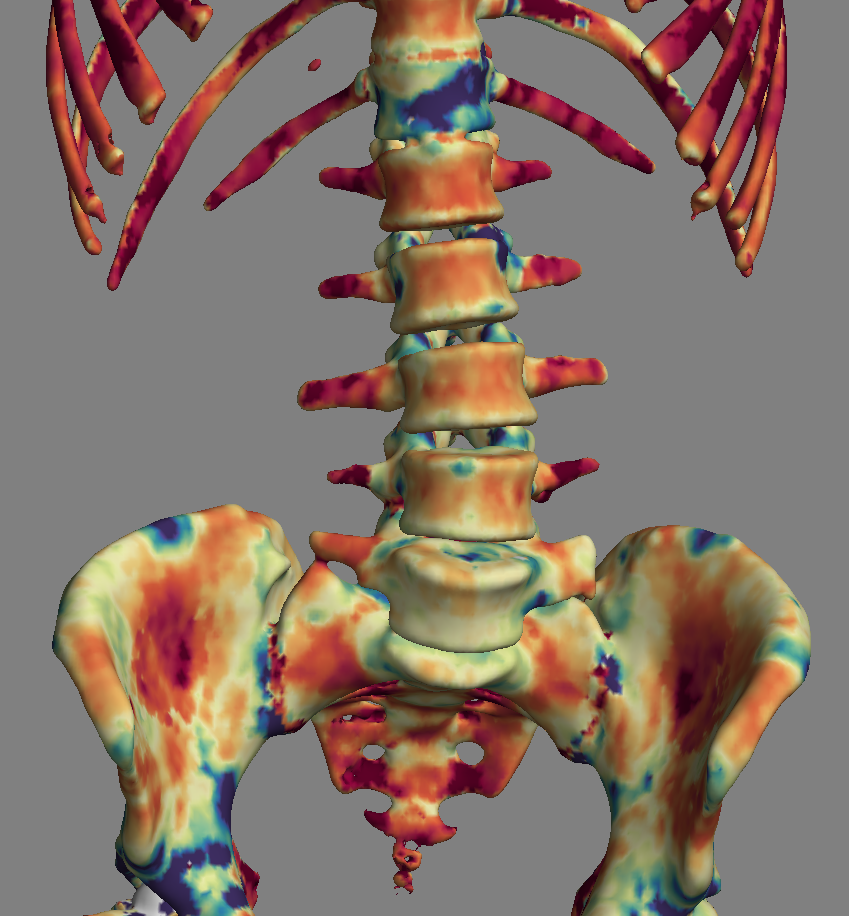 skeleton_trab_1.png