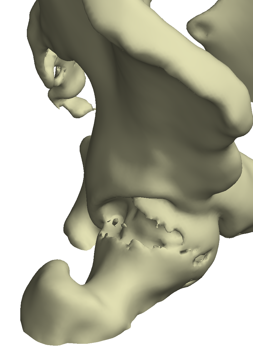 bone_surface_2.png