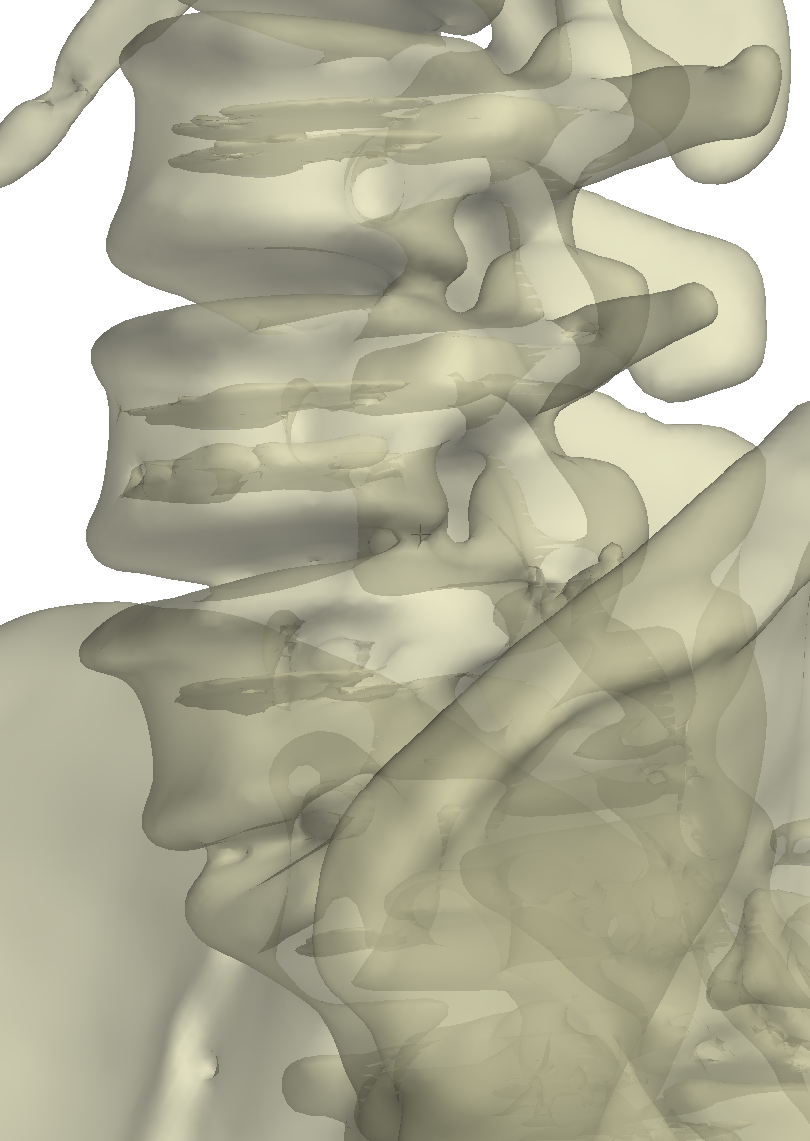 bone_surface_3.png