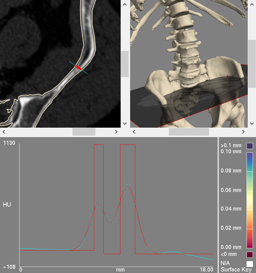 pelvis_cbm_2.png