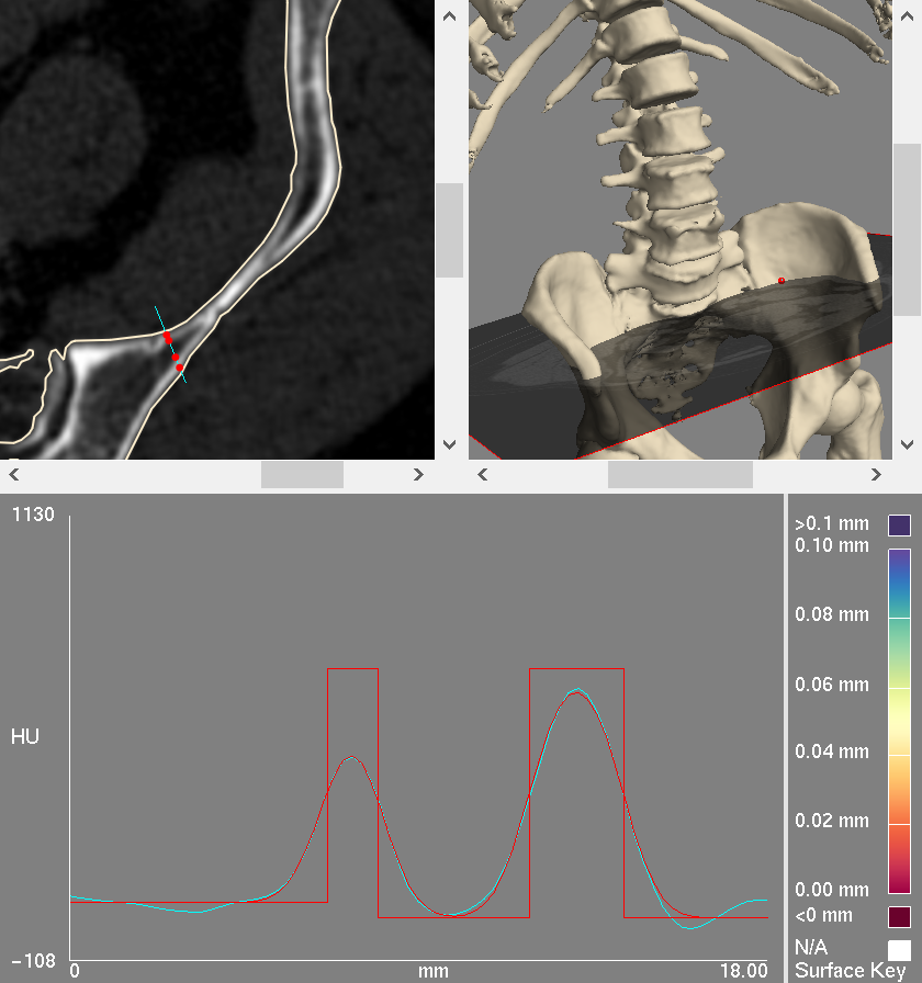 pelvis_cbm_3.png