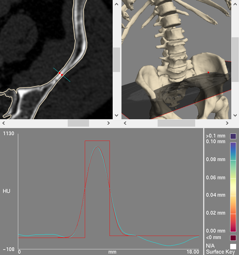 pelvis_cbm_4.png